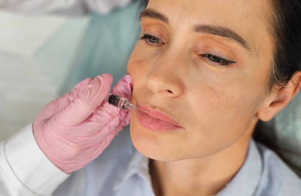 Vampire Facelift