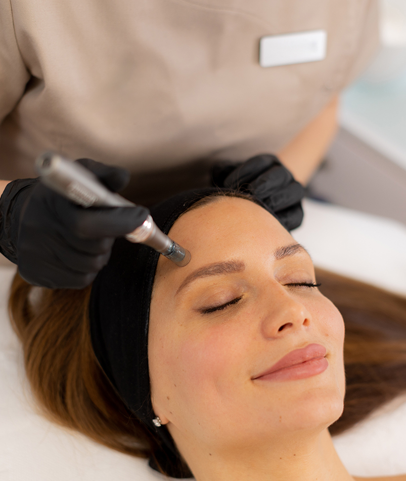 Vampire Facial